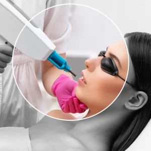 Modul: BKF (Regulär) - Haarentfernung mit Laser